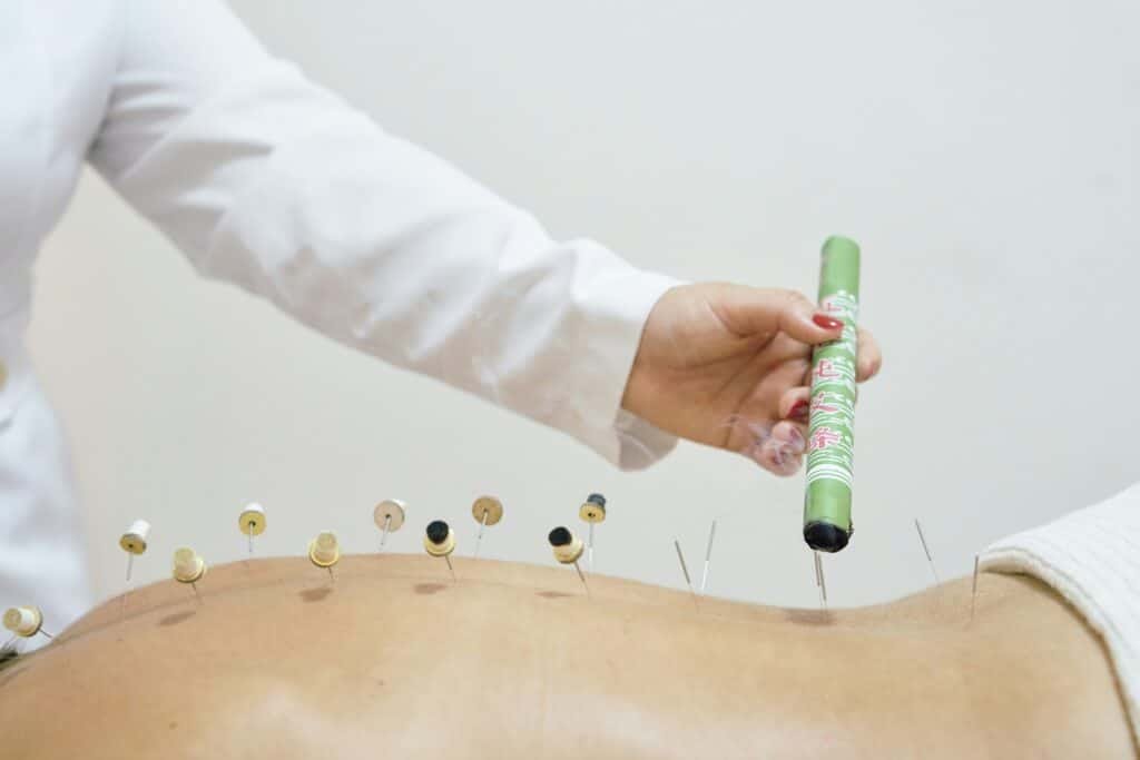 Séance de médecine chinoise - MTC